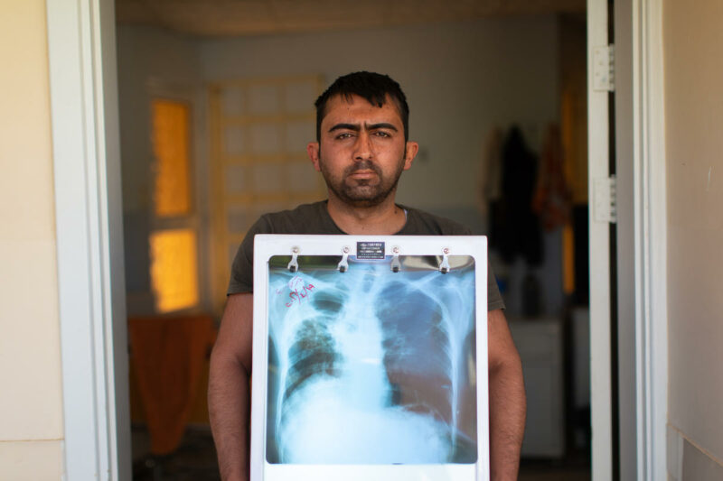 Journée mondiale de lutte contre la tuberculose : « Il faut continuer à se battre pour celles et ceux dont on n’entend pas la voix. » Le regard de Bertrand Pfouminzhouer Kampoer